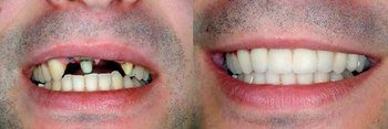 Smile Gallery - Farrell Dental, Lockport Dentist