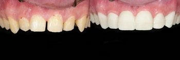 Smile Gallery - Farrell Dental, Lockport Dentist