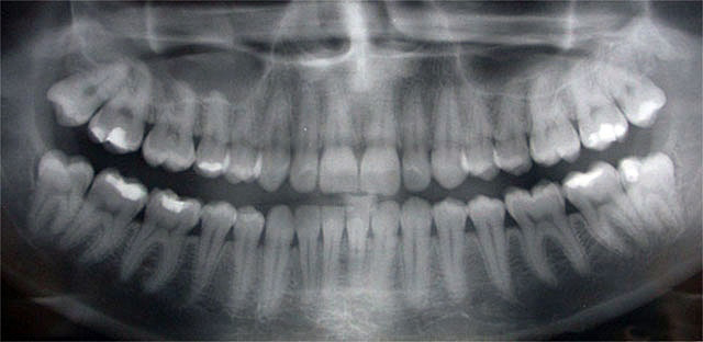 Carol Stream, IL Dentist - Simply Dental - General Dentist